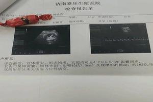 鸡西怀孕三个月无痛人流(鸡西怀孕三个月无痛人流多少钱啊)