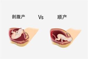 鸡西引产顺产的区别(引产生的快还是顺产生得快)