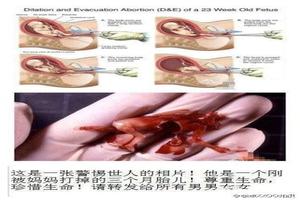 鸡西怀孕了不能引产(能引产吗)